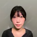 ヒアルロン酸注入（涙袋） / ヒアルロン酸注入（鼻） / ヒアルロン酸注入（あご） / ヒアルロン酸注入（唇） / ヒアルロン酸注入（頬） / ボトックス（肩） / ヒアルロン酸注入（鼻翼基部） HAAB×DREAM BEAUTY CLINIC 大阪梅田院 BEFORE サムネイル用