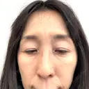 スネコス Natural Skin Clinic 自由ヶ丘院 BEFORE サムネイル用
