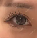 ヒアルロン酸注入（涙袋） フィラークリニック 大阪心斎橋院 BEFORE サムネイル用