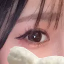 二重埋没 / 目頭切開 新宿美容外科ネビュラクリニック BEFORE サムネイル用