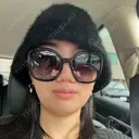 糸リフト / 脂肪吸引（顔） / ボトックス（エラ・小顔） Wing clinic 豊中駅前院 BEFORE サムネイル用