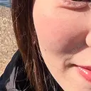 肌育注射（ジュベルックなど） / リジュラン 千葉美容外科アイビークリニック BEFORE サムネイル用