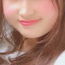 ボトックス（エラ・小顔） TCB東京中央美容外科 大宮東口院 BEFORE サムネイル用