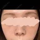 アートメイク（眉） G MEDICAL ART クリニック 新宿院 BEFORE サムネイル用