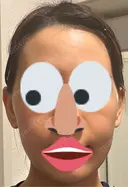 インモード PureMe Skin Clinic（ピュアミースキンクリニック麻布） BEFORE サムネイル用