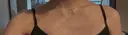 ボトックス（エラ・小顔） / ボトックス（肩） Tokyo Tensei Clinic 大阪梅田院 BEFORE サムネイル用