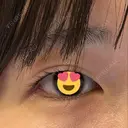 二重埋没 / 二重切開 新宿美容外科ネビュラクリニック BEFORE サムネイル用
