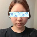糸リフト / 脂肪吸引（顔） 4Dクリニック BEFORE サムネイル用