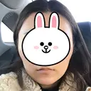 ボトックス（あご） / 脂肪溶解注射（顔） クリニックA.O. BEFORE サムネイル用