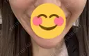その他（口元） 川崎かかりつけクリニック BEFORE サムネイル用
