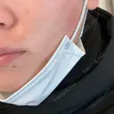 ルメッカ Moon Beauty Clinic BEFORE サムネイル用