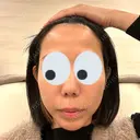 エレクトロポレーション / 毛穴洗浄（ハイドラフェイシャルなど） NOKA CLINIC BEFORE サムネイル用