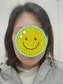 糸リフト / 脂肪吸引（顔） Days Beauty Clinic 新宿院 BEFORE サムネイル用