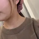 インモード Moon Beauty Clinic BEFORE サムネイル用