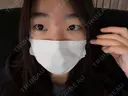 眼瞼下垂（切開） BIANCA銀座 BEFORE サムネイル用