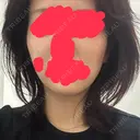 デンシティ 城本クリニック 新宿院 BEFORE サムネイル用