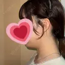 その他（輪郭） おおかみ美容のクリニック 新宿院 BEFORE サムネイル用