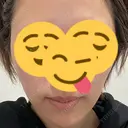 光治療（フォトフェイシャルなど） トラスト美容クリニック 銀座院 BEFORE サムネイル用