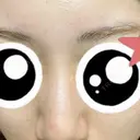 ルメッカ / LDM・インテンスウルトラ Chloe Cheongdam Clinic （クロエチョンダムクリニック） BEFORE サムネイル用