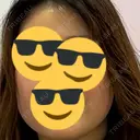 ボトックス（エラ・小顔） Natural Skin Clinic 自由ヶ丘院 BEFORE サムネイル用