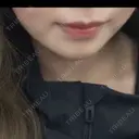 ヒアルロン酸注入（あご） HAAB BEAUTY CLINIC 名古屋院 BEFORE サムネイル用