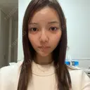 オンダリフト HAAB CLINIC 池袋院 BEFORE サムネイル用