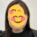 ボトックス（あご） / ボトックス（エラ・小顔） / ボトックス（口角） / RF（高周波）たるみ治療 ベールクリニック BEFORE サムネイル用