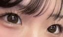 二重埋没 アリエル美容クリニック 郡山院 BEFORE サムネイル用