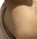 プラセンタ注射 タイムルクリニック BEFORE サムネイル用