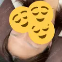 アートメイク（眉） LEAGRANT CLINIC 中目黒 BEFORE サムネイル用