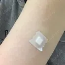 プラセンタ注射 ビクアスクリニック BEFORE サムネイル用