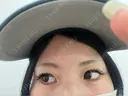 二重埋没 広島本通り美容クリニック BEFORE サムネイル用