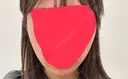 インモード BE ONE CLINIC BEFORE サムネイル用