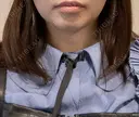 オンダリフト RIVER CLINIC（リバークリニック） BEFORE サムネイル用