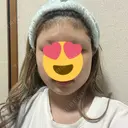 糸リフト / 脂肪吸引（顔） / ボトックス（エラ・小顔） PRISM Beauty Clinic 町田院 BEFORE サムネイル用