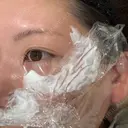水光注射（ハリ・美肌） GLAMRULE CLINIC (グラムルール クリニック) 銀座院 BEFORE サムネイル用