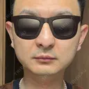 糸リフト / ボトックス（エラ・小顔） Tokyo Tensei Clinic 新宿院 BEFORE サムネイル用