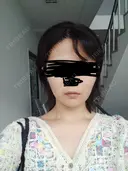 白玉点滴・注射 Aya Beauty & Family Clinic大阪院 BEFORE サムネイル用