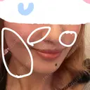 糸リフト ルラ美容クリニック 宇都宮院 BEFORE サムネイル用