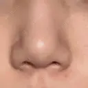 目頭切開 / 鼻尖形成（切開） / 軟骨移植 R Beauty CLINIC 銀座院 BEFORE サムネイル用