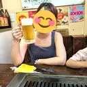 脂肪吸引（二の腕） / 脂肪吸引（お腹） / 脂肪吸引（腰） / 脂肪吸引（背中） / 脂肪吸引（肩） GAYA body design clinic BEFORE サムネイル用