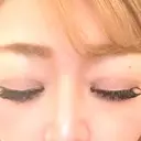 ボトックス（あご） / ボトックス（眉間） / ボトックス（目尻） / ボトックス（額） / ボトックス（バニーライン） 湘南美容クリニック 名古屋院 BEFORE サムネイル用