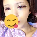 二重埋没 / 目頭切開 / 目尻切開 RG整形外科（旧リオン整形外科） BEFORE サムネイル用