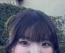 二重切開 / 目頭切開 / 眼瞼下垂（切開） / 目元修正 東京シンデレラ美容外科 新宿院 BEFORE サムネイル用