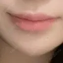 ヒアルロン酸注入（涙袋） / ヒアルロン酸注入（あご） / ヒアルロン酸注入（唇） 麻布十番クレールデンタルクリニック BEFORE サムネイル用