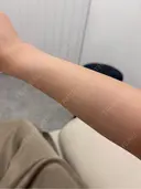 白玉点滴・注射 Aya Beauty & Family Clinic大阪院 BEFORE サムネイル用