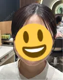 ボトックス（エラ・小顔） / ボトックス（眉間） / ボトックス（額） ルラ美容クリニック 大阪心斎橋院 BEFORE サムネイル用