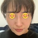 PRP皮膚再生療法 聖心美容クリニック 名古屋院 BEFORE サムネイル用