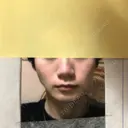 隆鼻術 / 鼻尖形成（切開） / 鼻中隔延長（切開） / 小鼻縮小（切開） / 軟骨移植 / 鼻孔縁挙上 / 鼻尖縮小 Zetith Beauty Clinic 銀座院 BEFORE サムネイル用