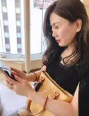 隆鼻術 / 鼻尖形成（切開） / 糸リフト / 骨削り（エラ） / 骨削り（頬） / 脂肪吸引（顔） RG整形外科（旧リオン整形外科） BEFORE サムネイル用